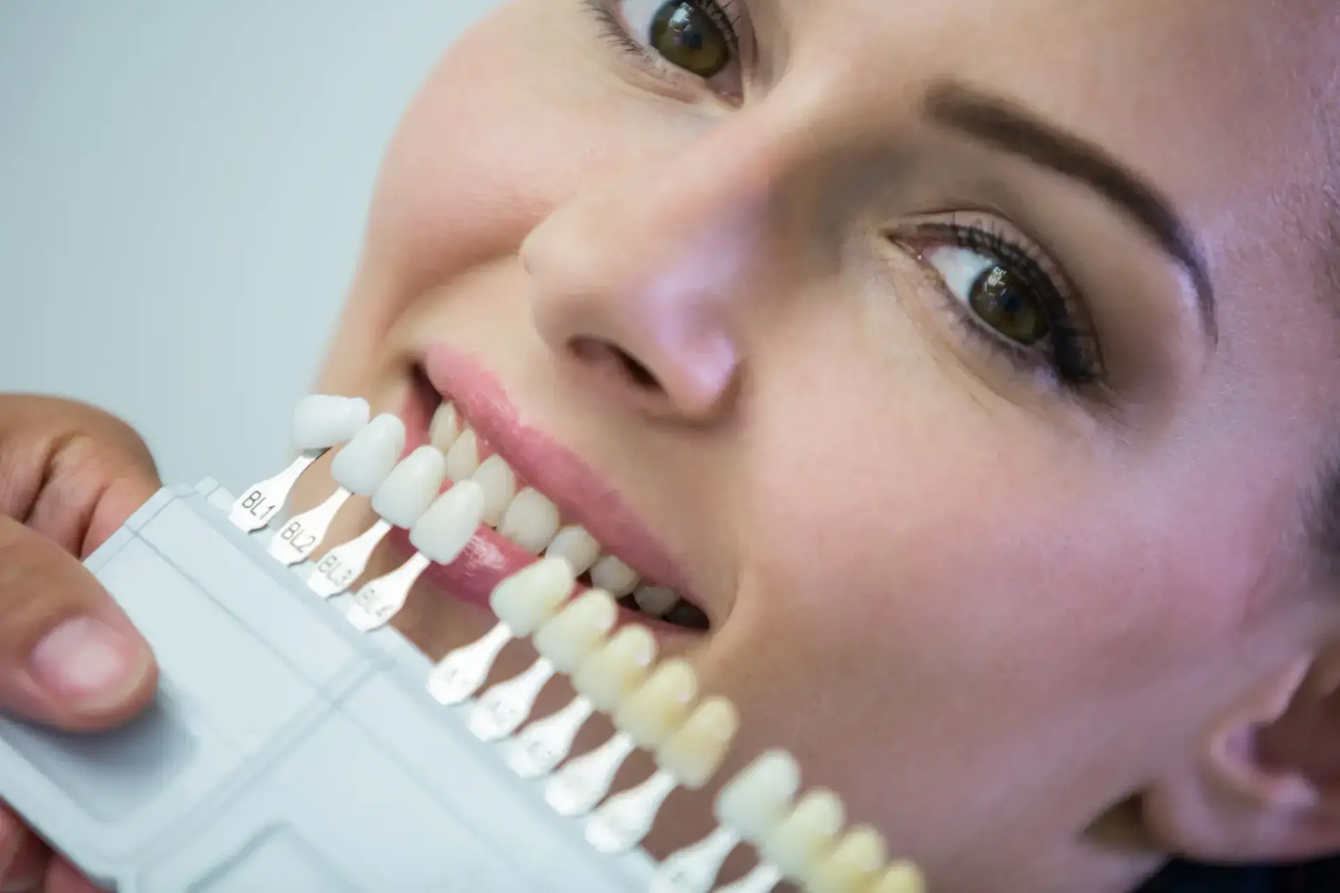 Dental Veneers in Turkey Cost and Clinics